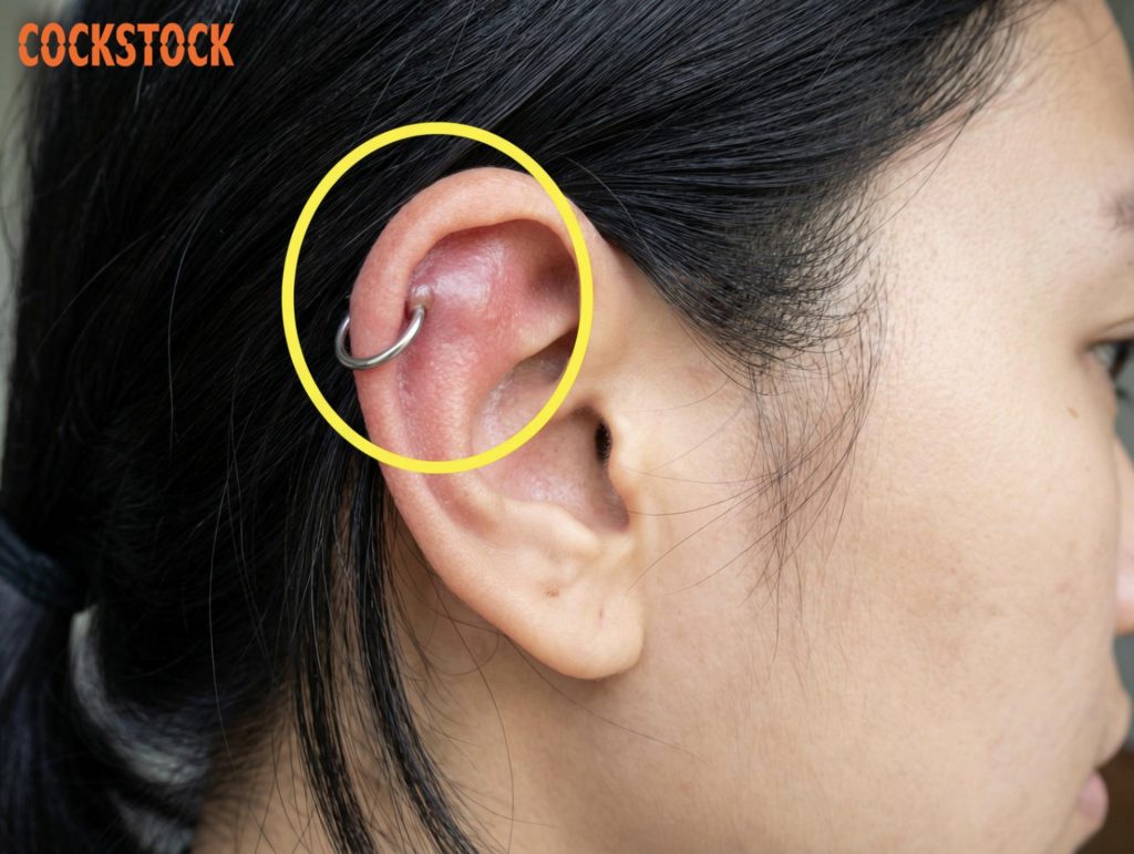 cách đeo khuyên tai không bị sưng