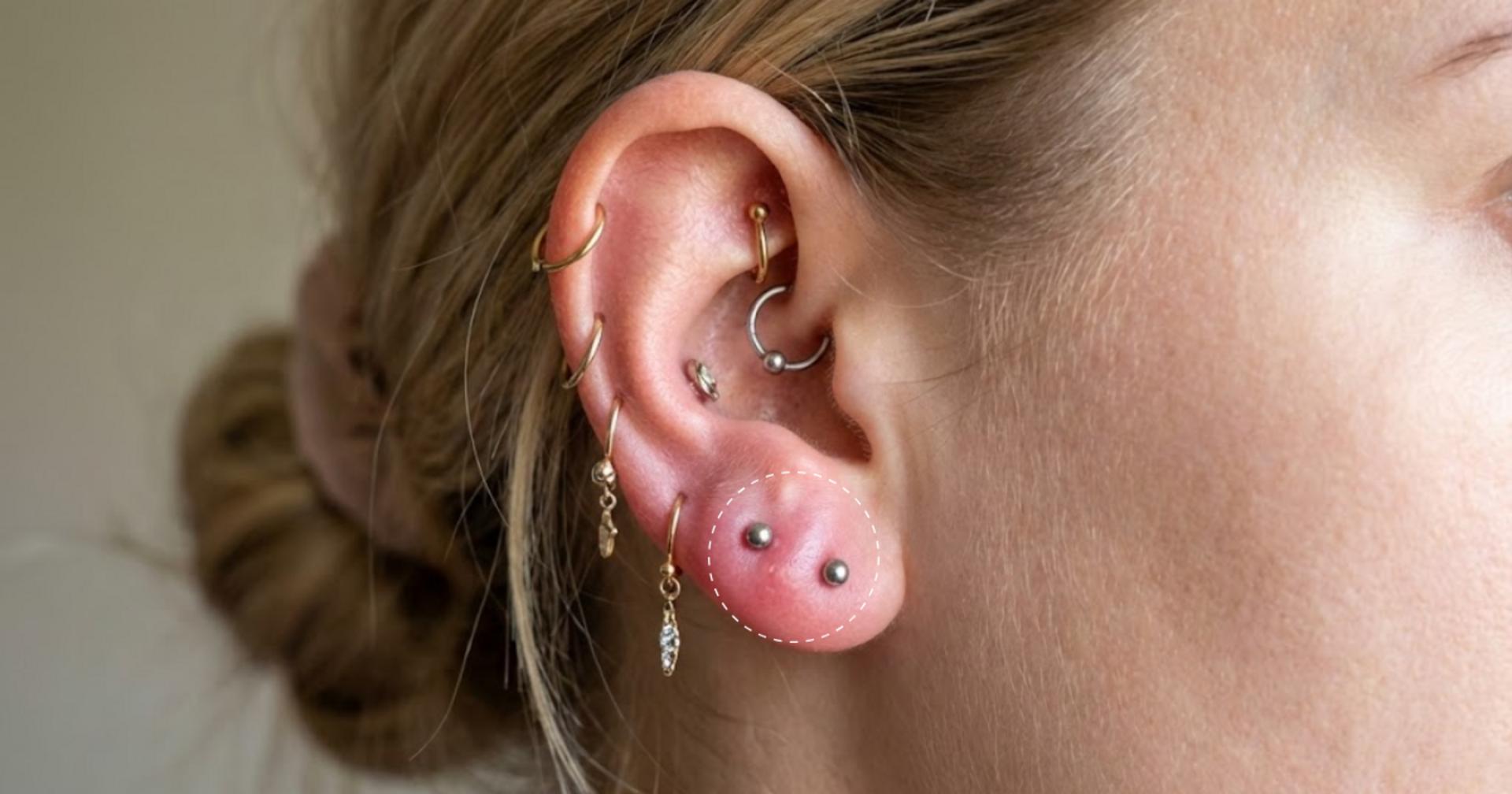 Tai dễ bị “quá tải” khi bạn xỏ cùng lúc quá nhiều lỗ hoặc chăm sóc hời hợt.