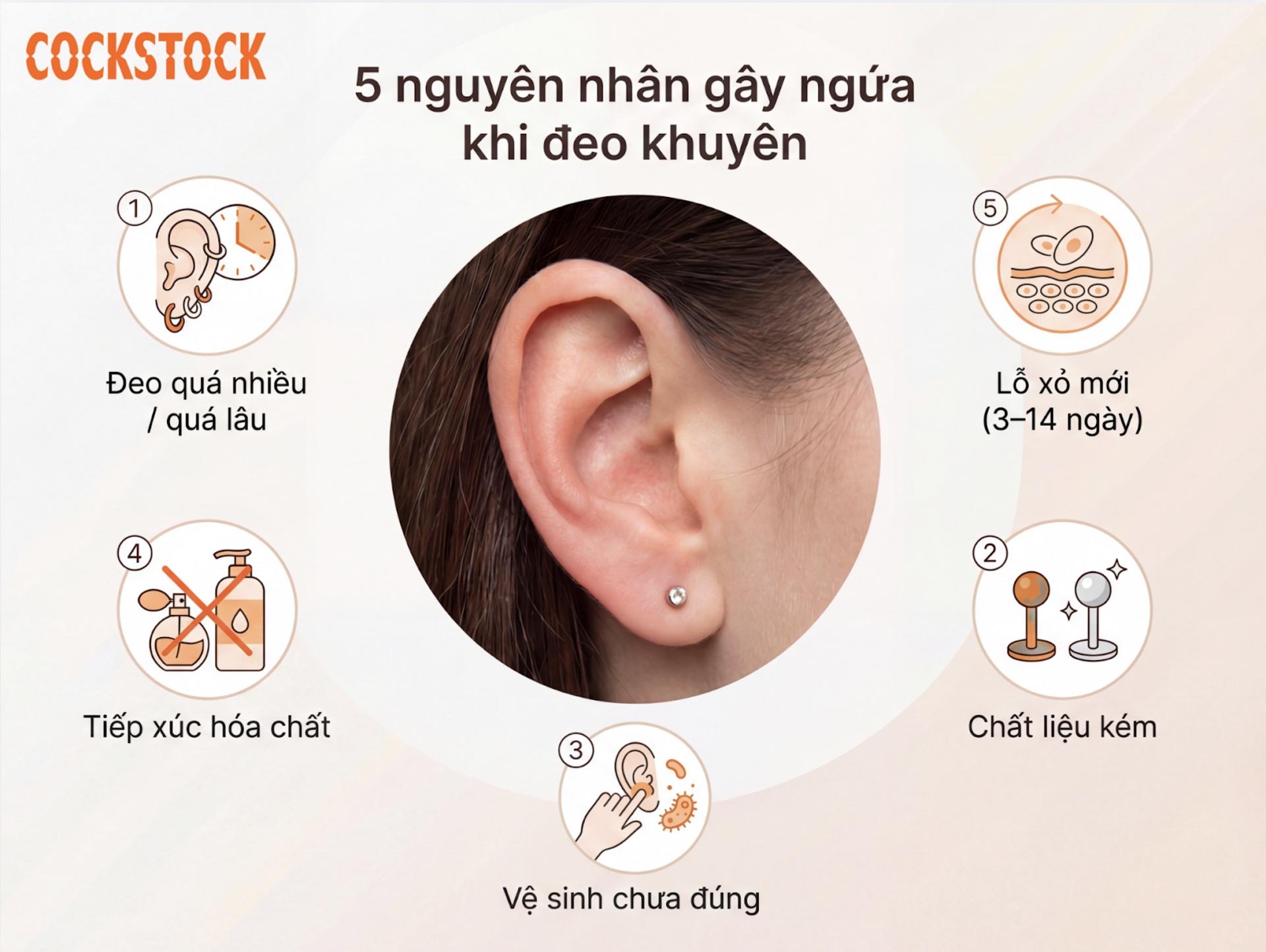Một số nguyên nhân có thể gây ngứa khi đeo khuyên