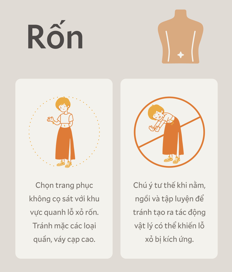 Do vị trí xỏ nhạy cảm và dễ bị tác động nên nếu xỏ khuyên rốn, bạn cần ưu tiên mặc đồ thoải mái và tránh các tác động vật lý (va quệt, nằm đè) để lỗ xỏ luôn khô thoáng, mau lành